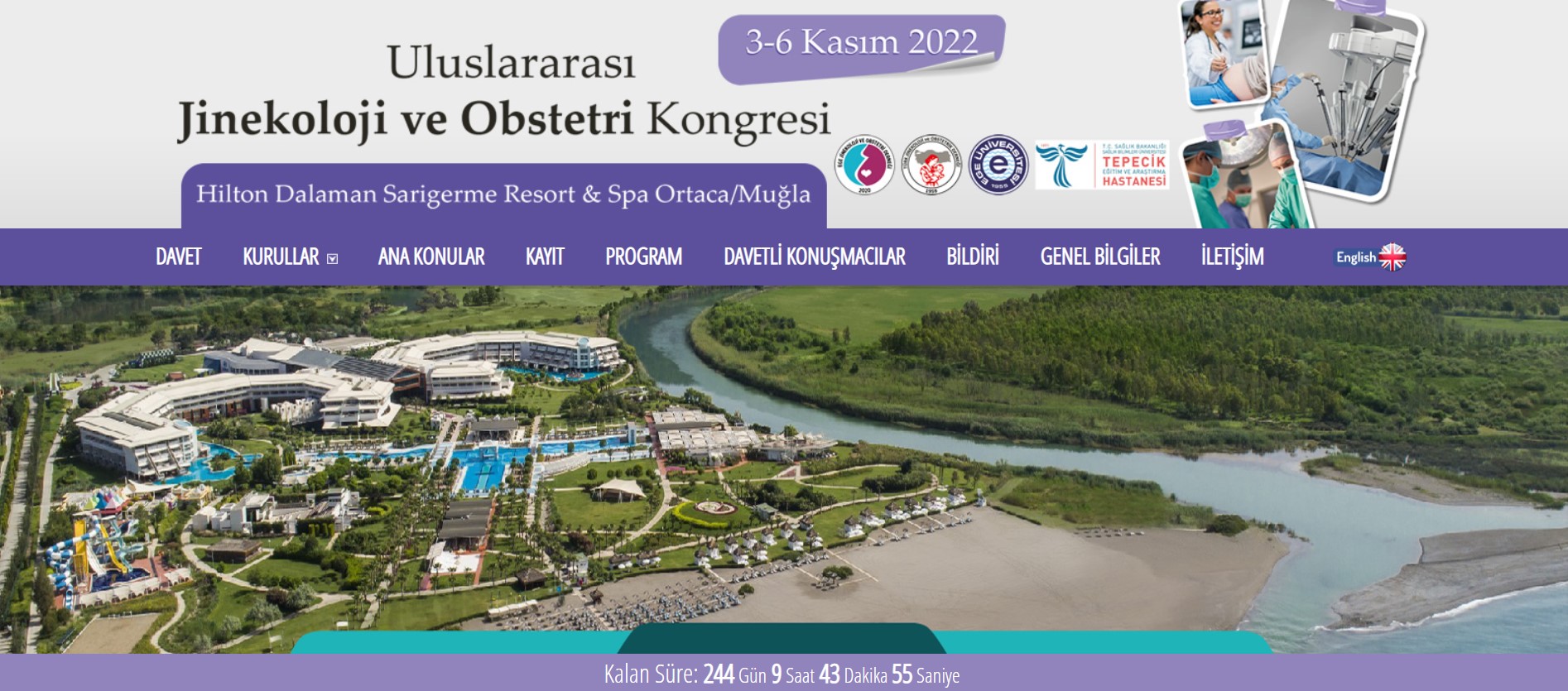 Uluslararası Jinekoloji ve Obstetri kongresi 2022