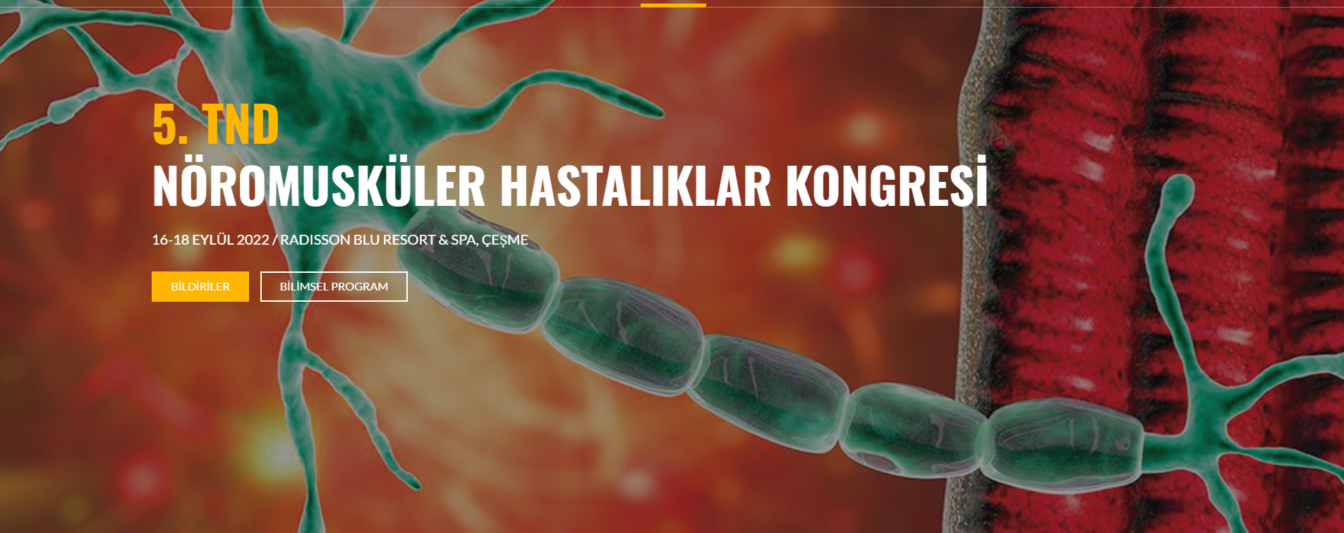 5. TND Nöromusküler Hastalıklar Kongresi